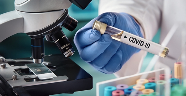 Farkında Olmadan Koronavirüs Geçirip Geçirmediğinizi Test Yaptırarak Öğrenebilirsiniz