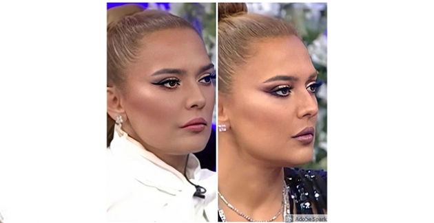 Demet Akalın'dan Jennifer Lopez'e Ünlülerin Tercihi Ameliyatsız Güzellik