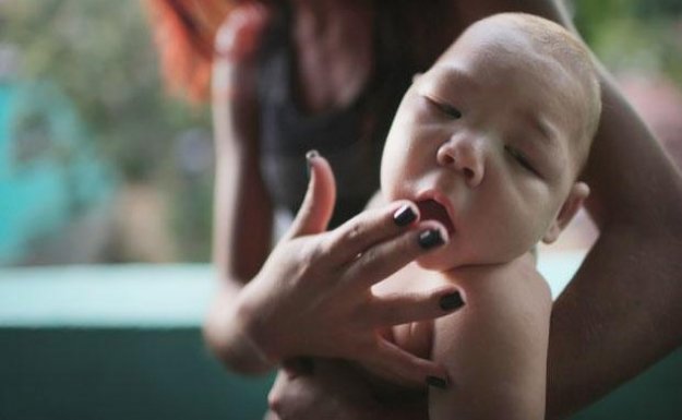 Zika Virüsü Kapan Kadınlara Kürtaj İzni 
