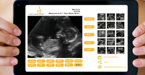 Karnınızdaki Bebeği Evinizdeki Ultrason Cihazı İle İzleyin