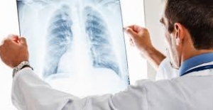 Akciğer Kanserinde Ölüm Oranları Giderek Azalıyor
