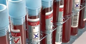 HIV’de Tedavi Mümkün, Zor Olan Hastaya Ulaşmak