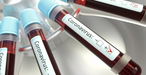 Dr. Yüksel Büküşoğlu, "Diyabet İlacı Metformin Koronavirüse Bağlı Ölümleri Önlüyor!"