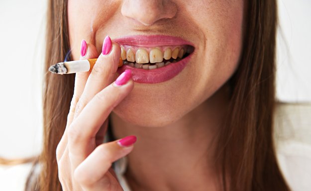 Sigara İçenler Dişlerini Günde 3 Kez Fırçalamalı